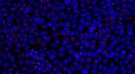 Cellules ciliées néphtronophtise