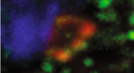 cellules dendritiques