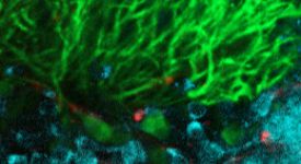 Cellules de Purkinje