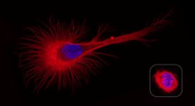 La cellule mutée présente une forme anormale (contrôle à droite)