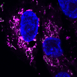 Mitochondrial DNA (green) escapes from the mitochondria (pink), causing an abnormal immune response