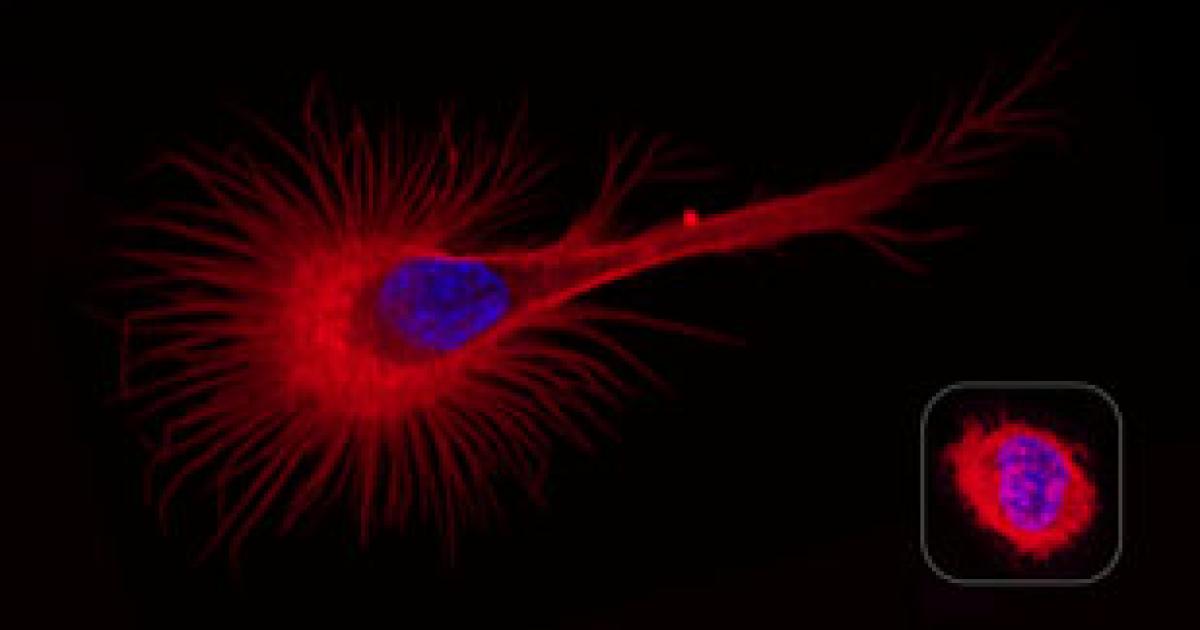 Discovery of DOCK11 mutations responsible for a new Xlinked autoimmune